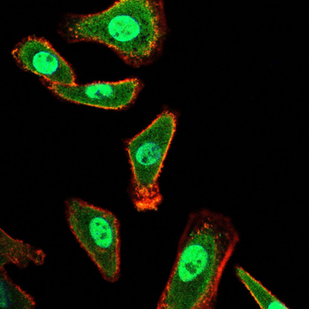 STAT5B Rabbit Polyclonal Antibody