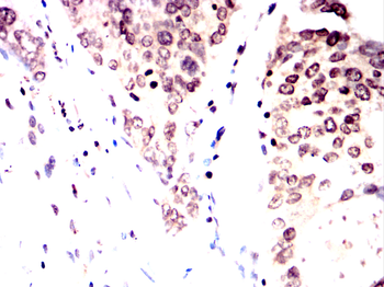 STAT5B Rabbit Polyclonal Antibody