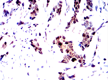 STAT5B Rabbit Polyclonal Antibody