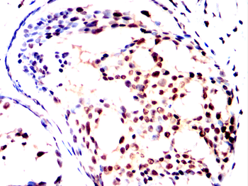 STAT5B Rabbit Polyclonal Antibody