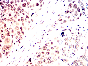 STAT5B Rabbit Polyclonal Antibody