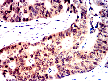 STAT5B Rabbit Polyclonal Antibody