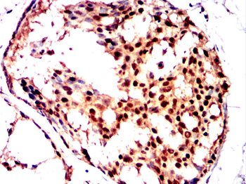 FLT4 Antibody