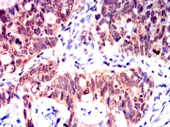 ERBB2 Antibody