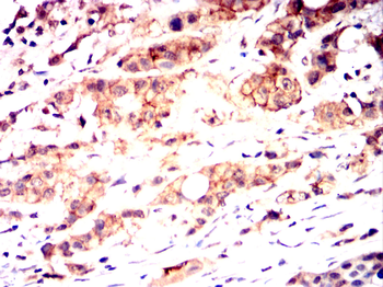 ERBB2 Antibody
