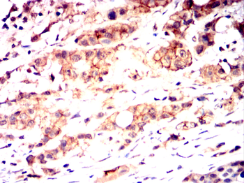 ERBB2 Antibody