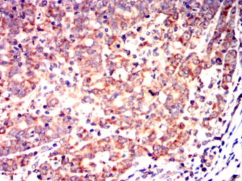 CSK Antibody