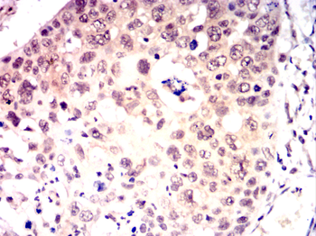 CRTC2 Antibody