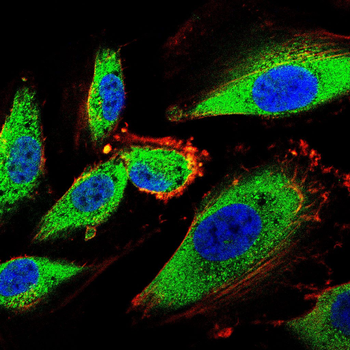 FCER2 Rabbit Polyclonal Antibody