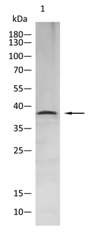 FCER2 Rabbit Polyclonal Antibody