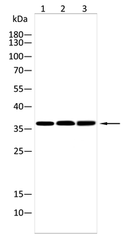 FCER2 Rabbit Polyclonal Antibody