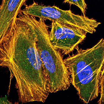 NR3C1 Antibody