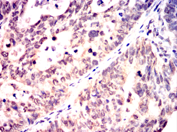 c-Rel Rabbit Polyclonal Antibody