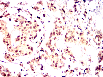 c-Rel Rabbit Polyclonal Antibody