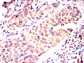 c-Rel Rabbit Polyclonal Antibody