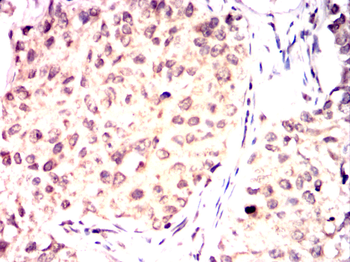 LATS1 Antibody
