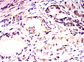 LATS1 Antibody