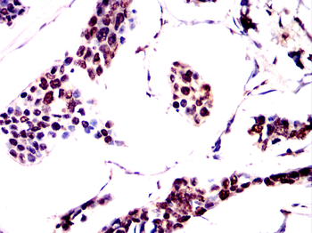 XRCC5 Antibody