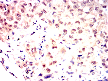 XRCC5 Antibody