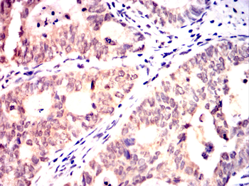 AURKB Antibody