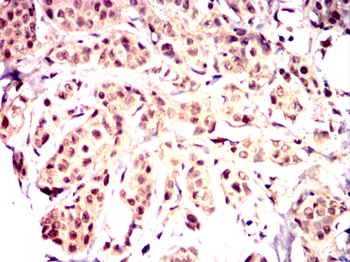 SGK1 Antibody