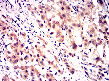 IGF2R Antibody