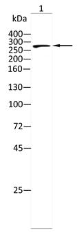 IGF2R Antibody