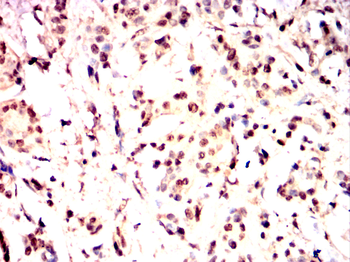 CHEK1 Antibody