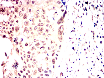 CHEK1 Antibody