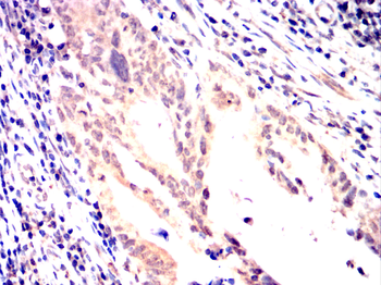 CARM1 Antibody
