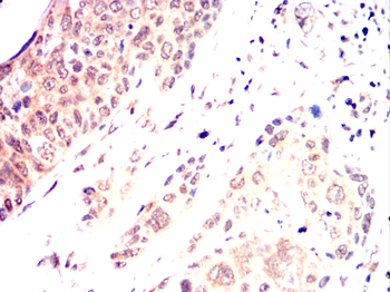 CARM1 Antibody