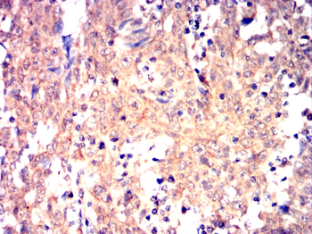 CARM1 Antibody