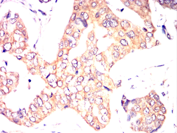 NGFR Antibody