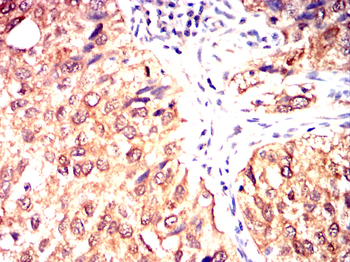NGFR Antibody