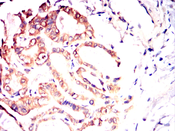 NGFR Antibody
