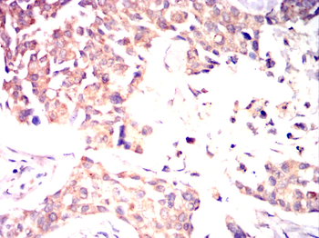 PIEZO1 Antibody