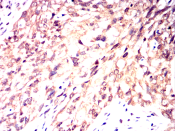 PIEZO1 Antibody