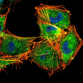 RAF1 Antibody