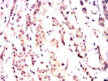 RAF1 Antibody