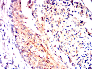RAF1 Antibody