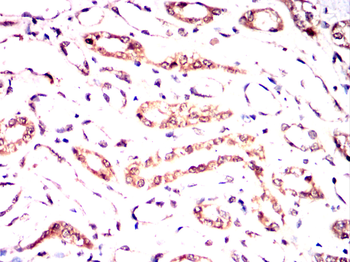 LRP5 Antibody