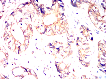 LRP5 Antibody