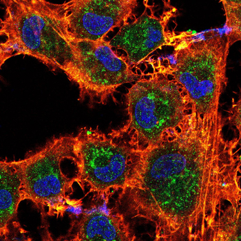 HSPA4 Antibody