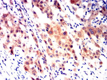 HSPA4 Antibody