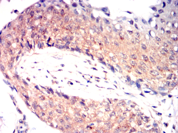 HSPA4 Antibody