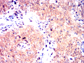 HSPA4 Antibody