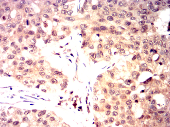 PSMB8 Antibody