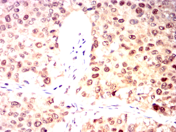 MCM2 Antibody