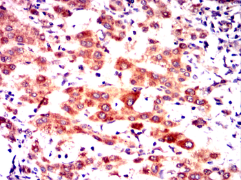 RAB20 Antibody