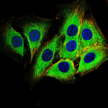 GSTM1 Antibody